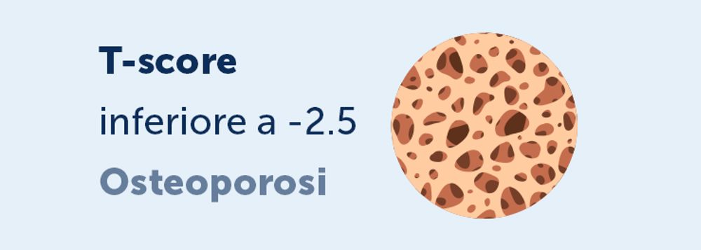 Tscore Osteoporosi
